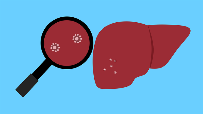 La SAP emitió un alerta sobre el brote de hepatitis de origen desconocido. ¿Qué advirtieron? (Foto: Pixabay)