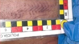 Fernando Báez Sosa tenía una marca de 6 centímetros en el mentón producto de una patada. Fernando Báez Sosa tenía una marca de 6 centímetros en el mentón producto de una patada.