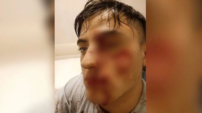 Brutal ataque a un joven: podría perder la vista de un ojo