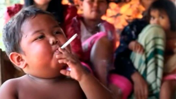 Así está Aldi Rizar, el niño de año y medio que fumaba 40 cigarrillos por día